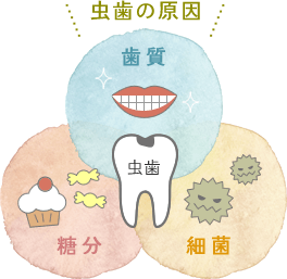 虫歯の原因は「歯質」「糖分」「細菌」